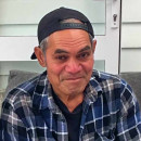 BURN: Wales Charles Salemanesa